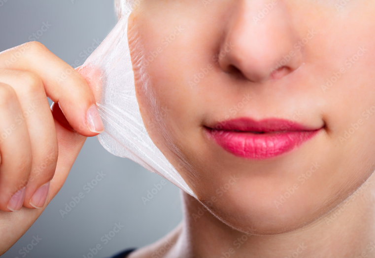 PEELING QUIMICO